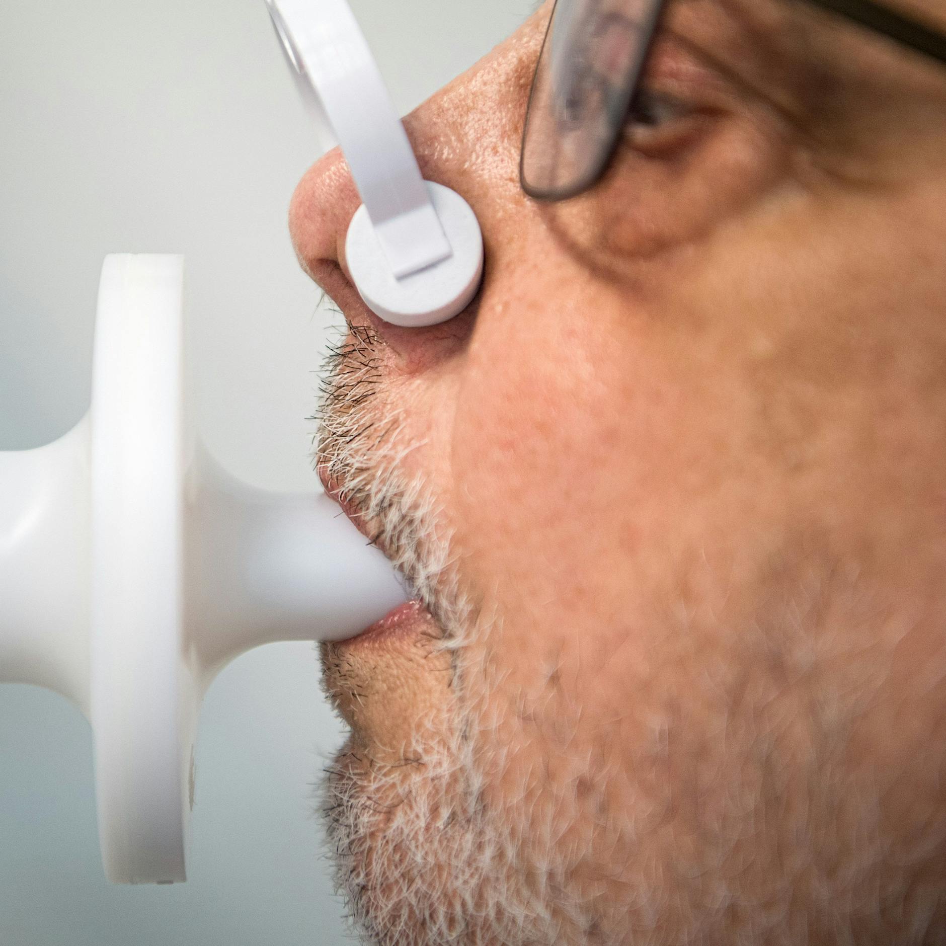 Nach Corona-Infektion: 40 Prozent der Betroffenen leiden an Long Covid