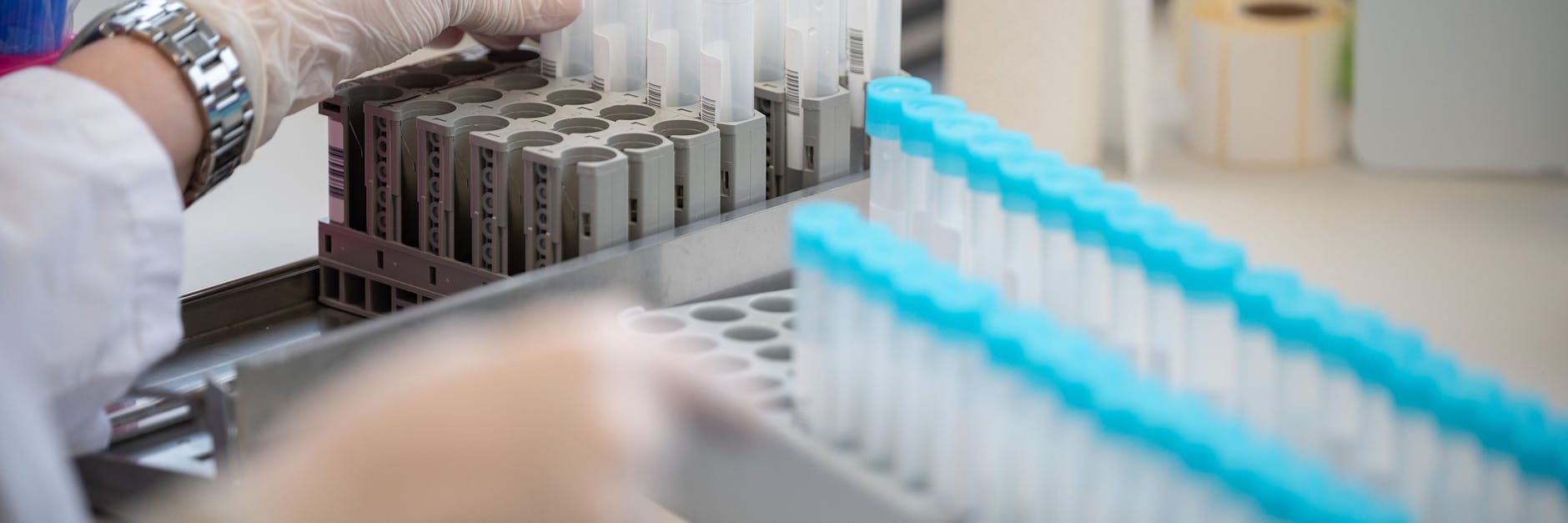 Vorbereitung für einen PCR-Test. (Symbolbild)