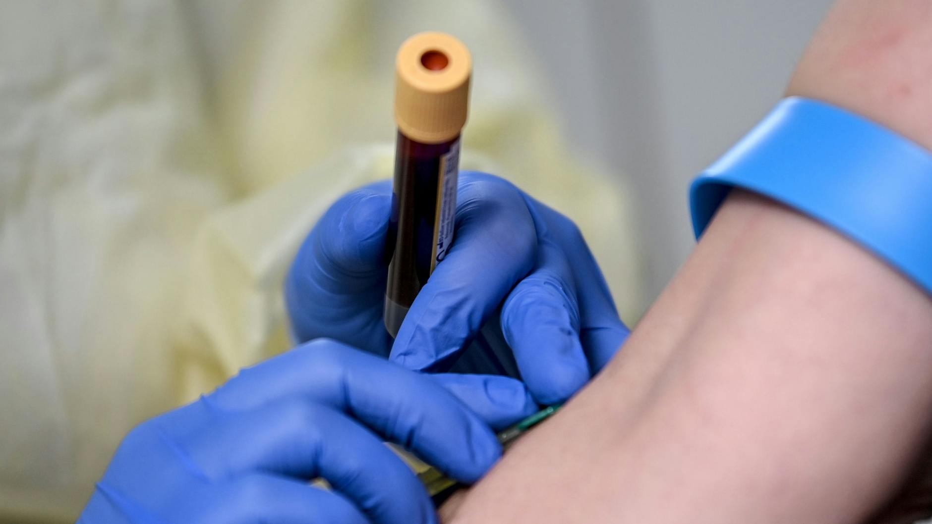 Auch in menschlichem Blut findet sich Mikroplastik (Symbolbild).