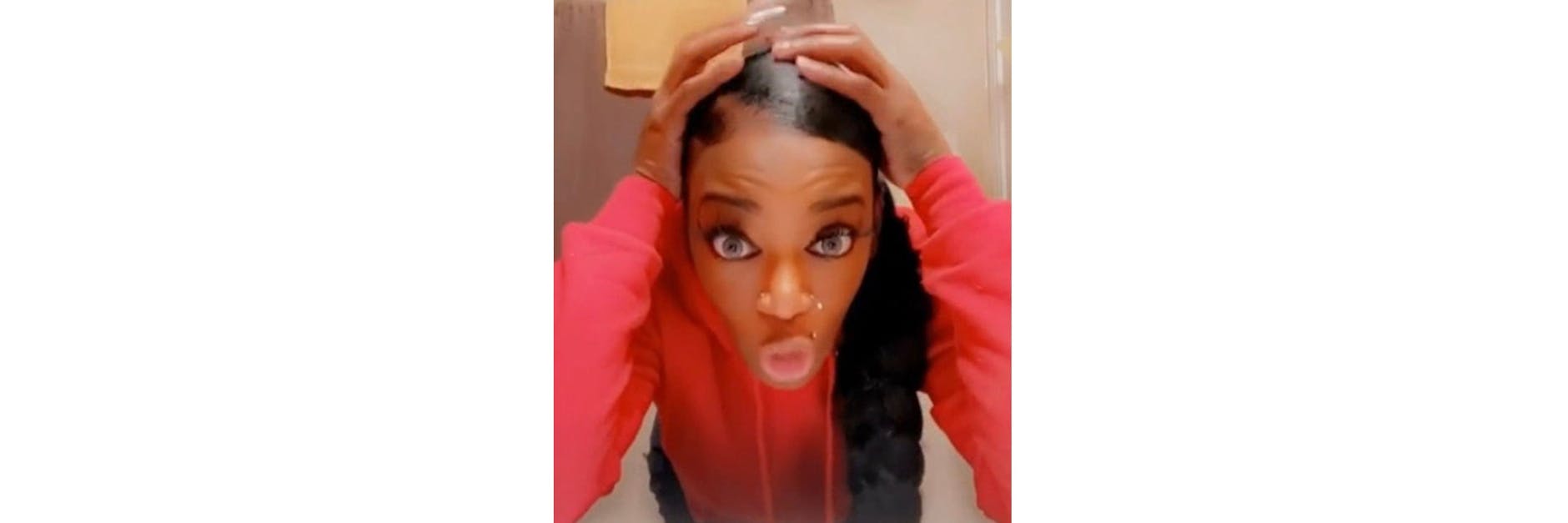 Tessica Brown hatte über einen Monat lang Sekundenkleber in den Haaren. 