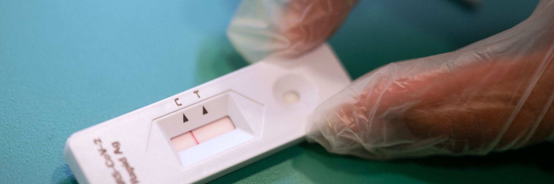 Bald schon könnten Schnelltest für den Selbstgebrauch zugelassen werden.