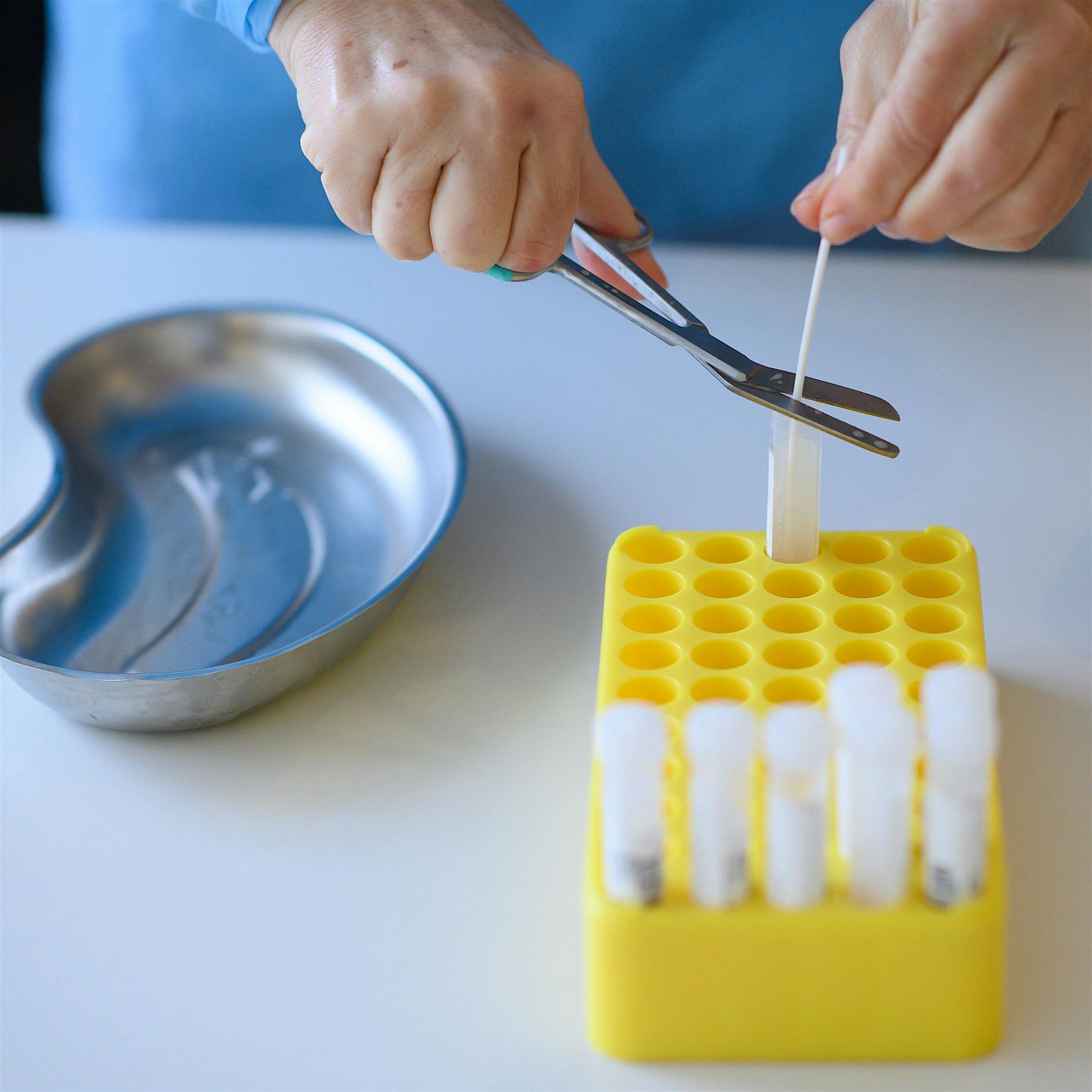 Pandemie in Deutschland: 7676 Neuinfektionen am Sonntag, Inzidenz über 60