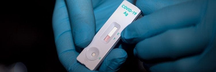 Bisher durften nur medizinische Einrichtungen testen – bald gibt es den Corona-Schnelltest für zu Hause auch in Apotheken und Discountern zu kaufen.