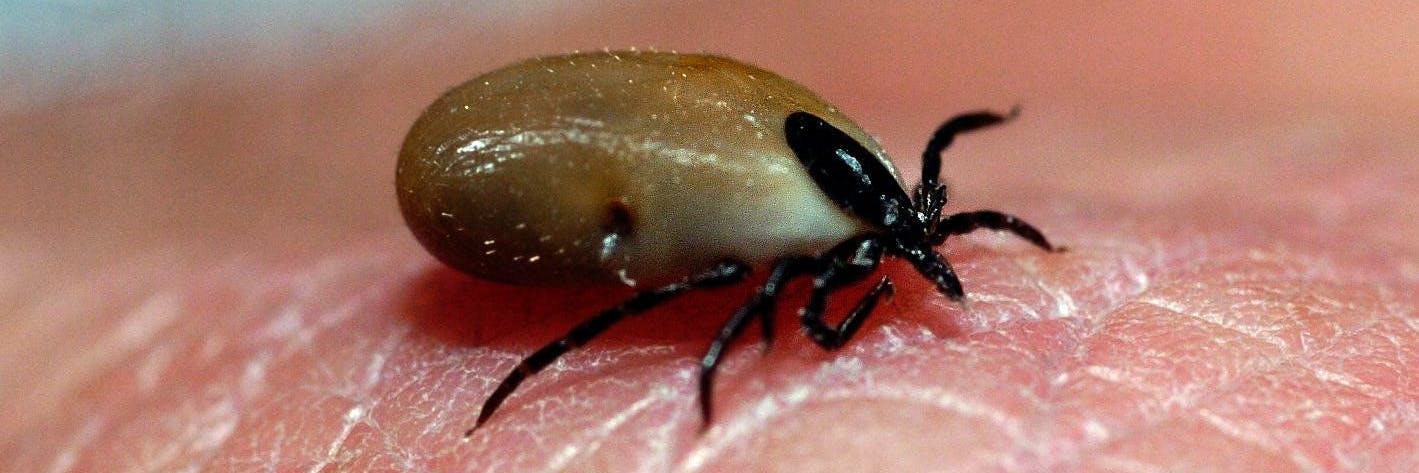 Eine Zecke auf der Haut eines Menschen – das Risiko einer schweren Erkrankung kann man durch eine Impfung minimieren.
