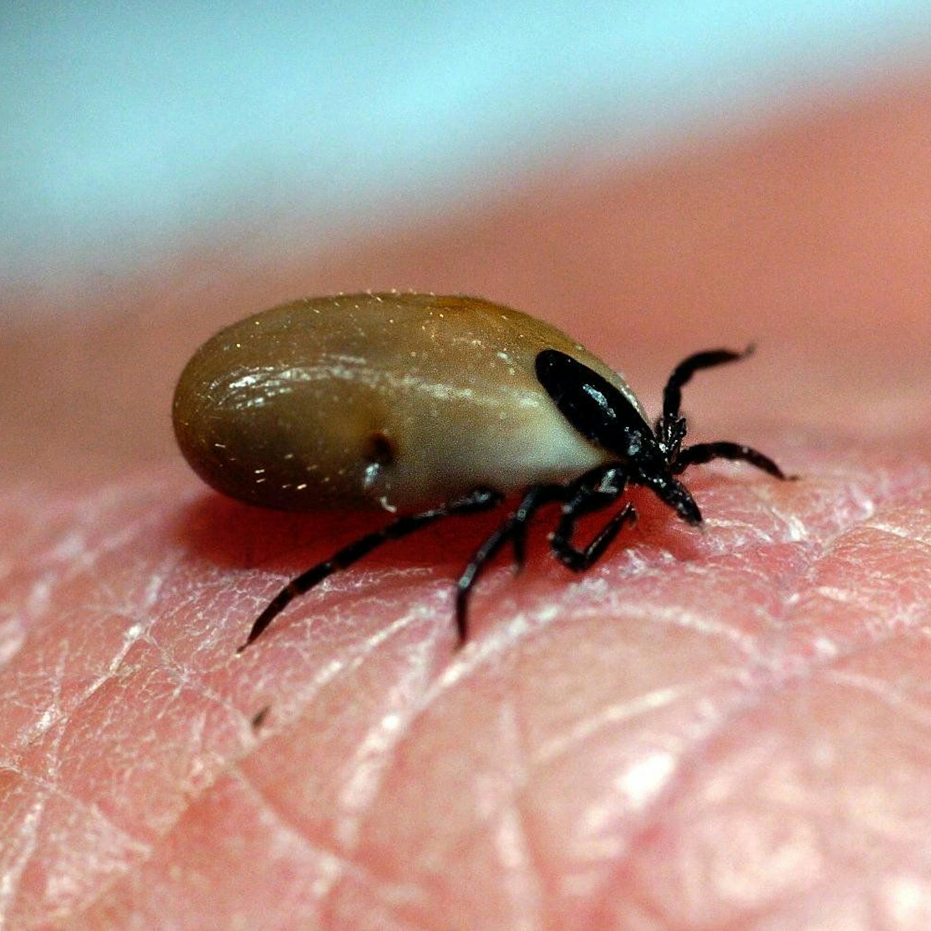 Risiko Zeckenstich: Wer sich dringend impfen lassen sollte