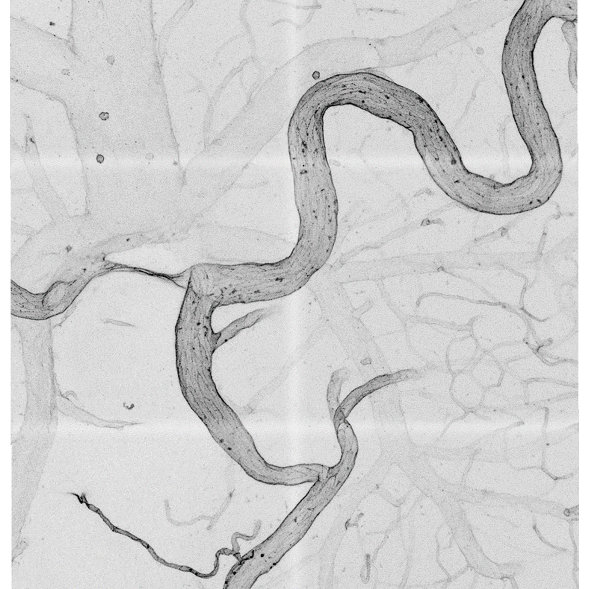 Bild eines Schlaganfalls im Gehirn. Das schlangenförmige Gefäß ist eine sogenannte Kollaterale, die nach dem&nbsp; Schlaganfall durch mehr Blutfluss größer und funktional wird.