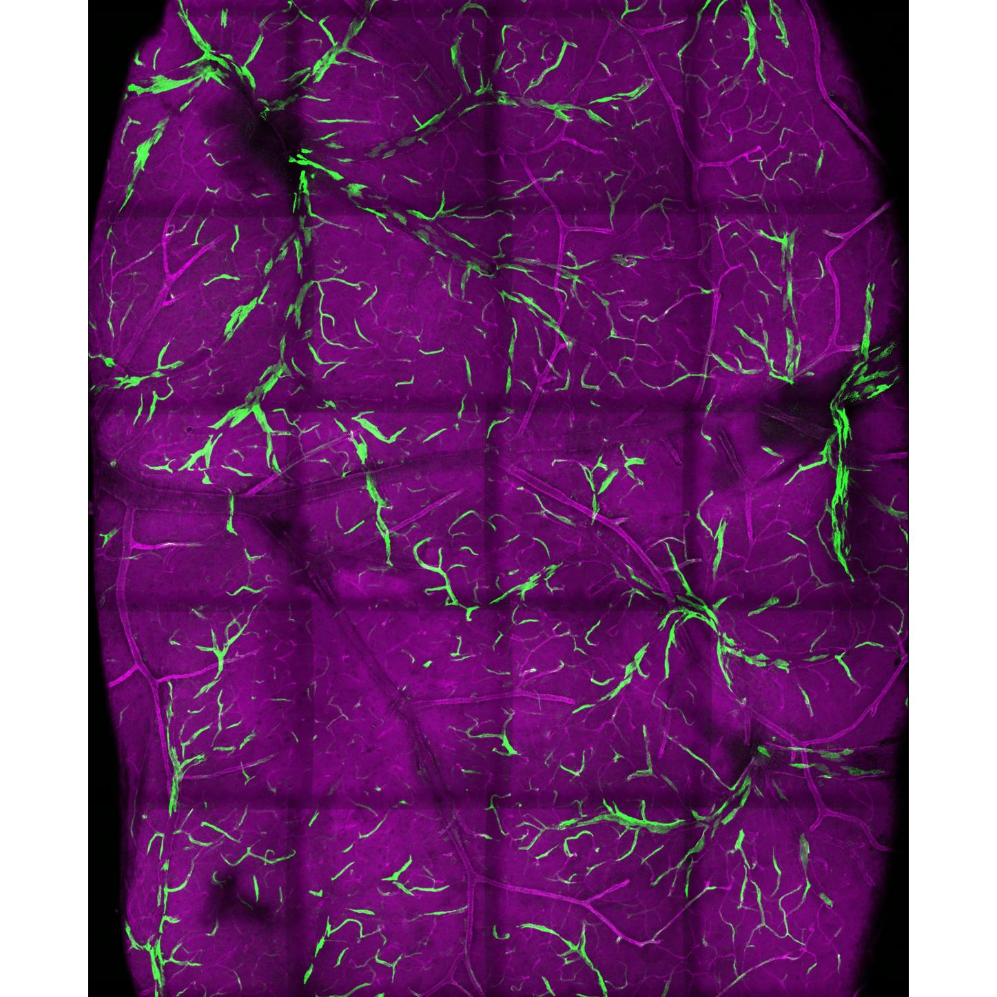 Netze von Blutgefäßen im Gehirn