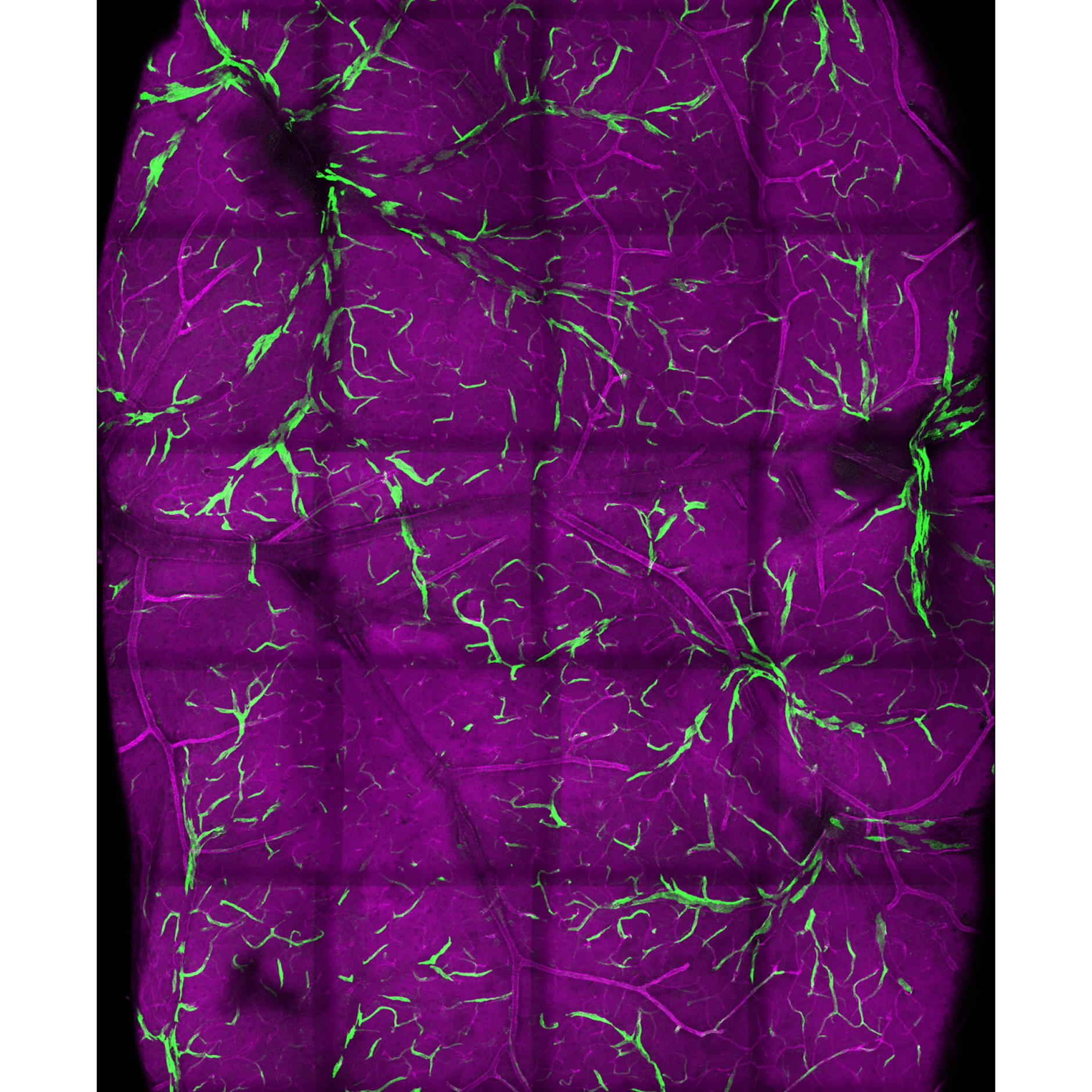 Netze von Blutgefäßen im Gehirn