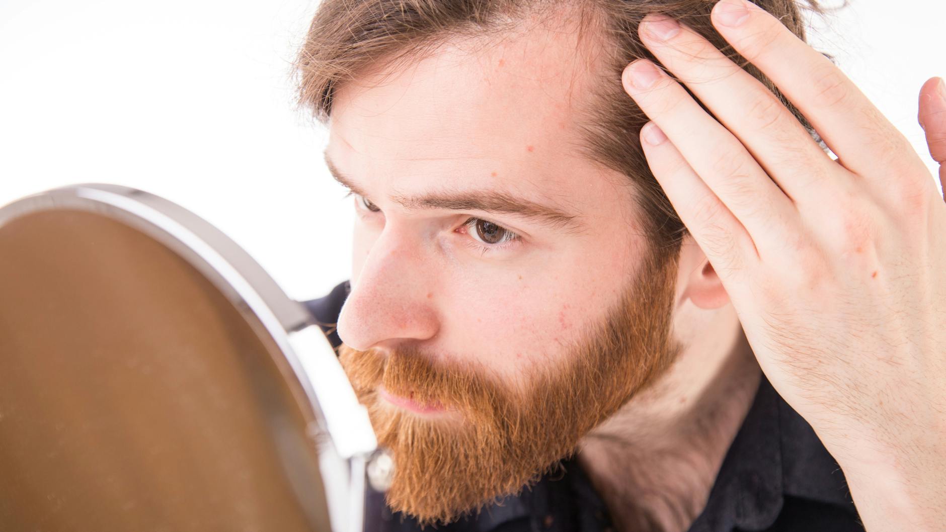 Während der eine es locker nimmt, leidet der andere massiv – unterschätzen sollte man den Einfluss des Haarausfalls auf die Psyche nicht.