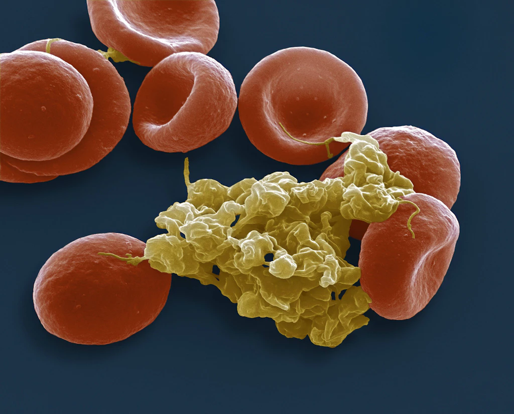 Astrazeneca: Jetzt auch Berichte von Bauchvenen-Thrombosen