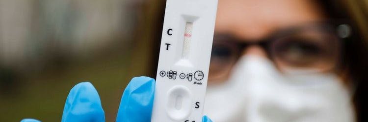 Ab dem 1. April darf der Inzidenzwert nicht mehr das alleinige Kriterium für Verbote, Einschränkungen und weitere Lockdown-Maßnahmen sein.