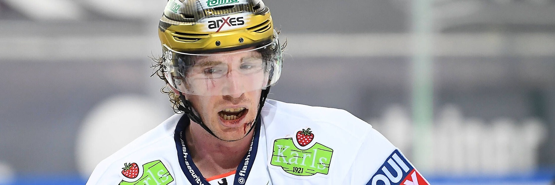 Tun schon beim Hinsehen weh: John Ramage wurde in Straubing während des Spiels im Gesicht genäht.&nbsp;