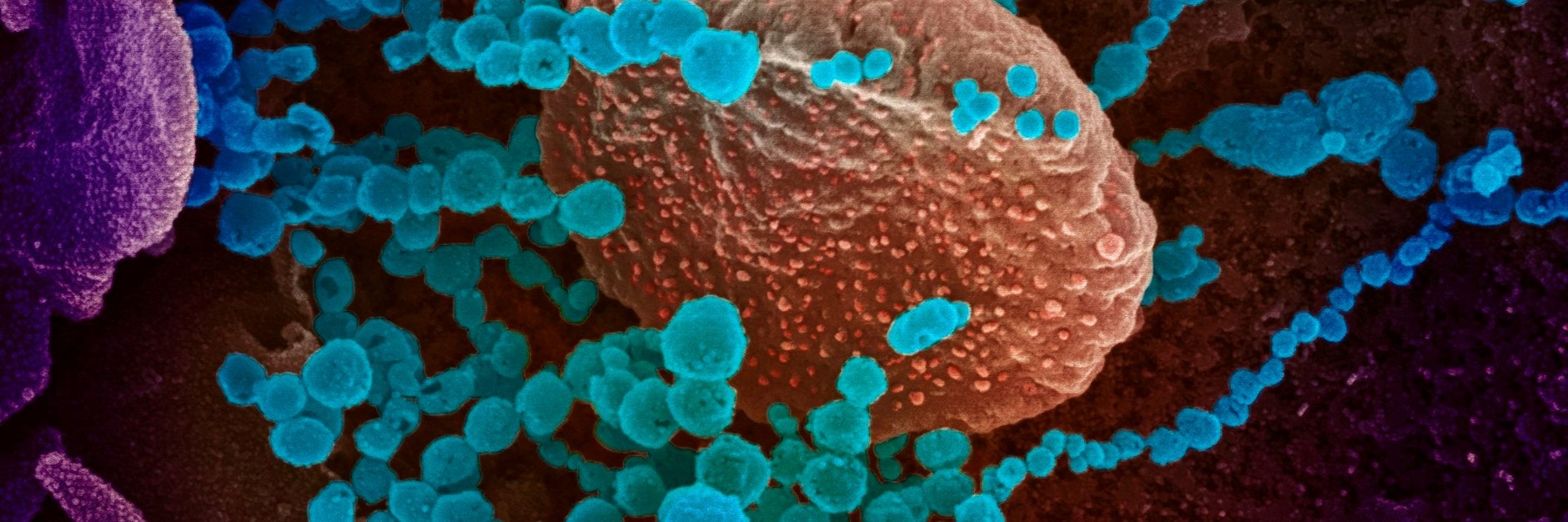 Coronaviren (blau) unter dem Elektronenmikroskop.