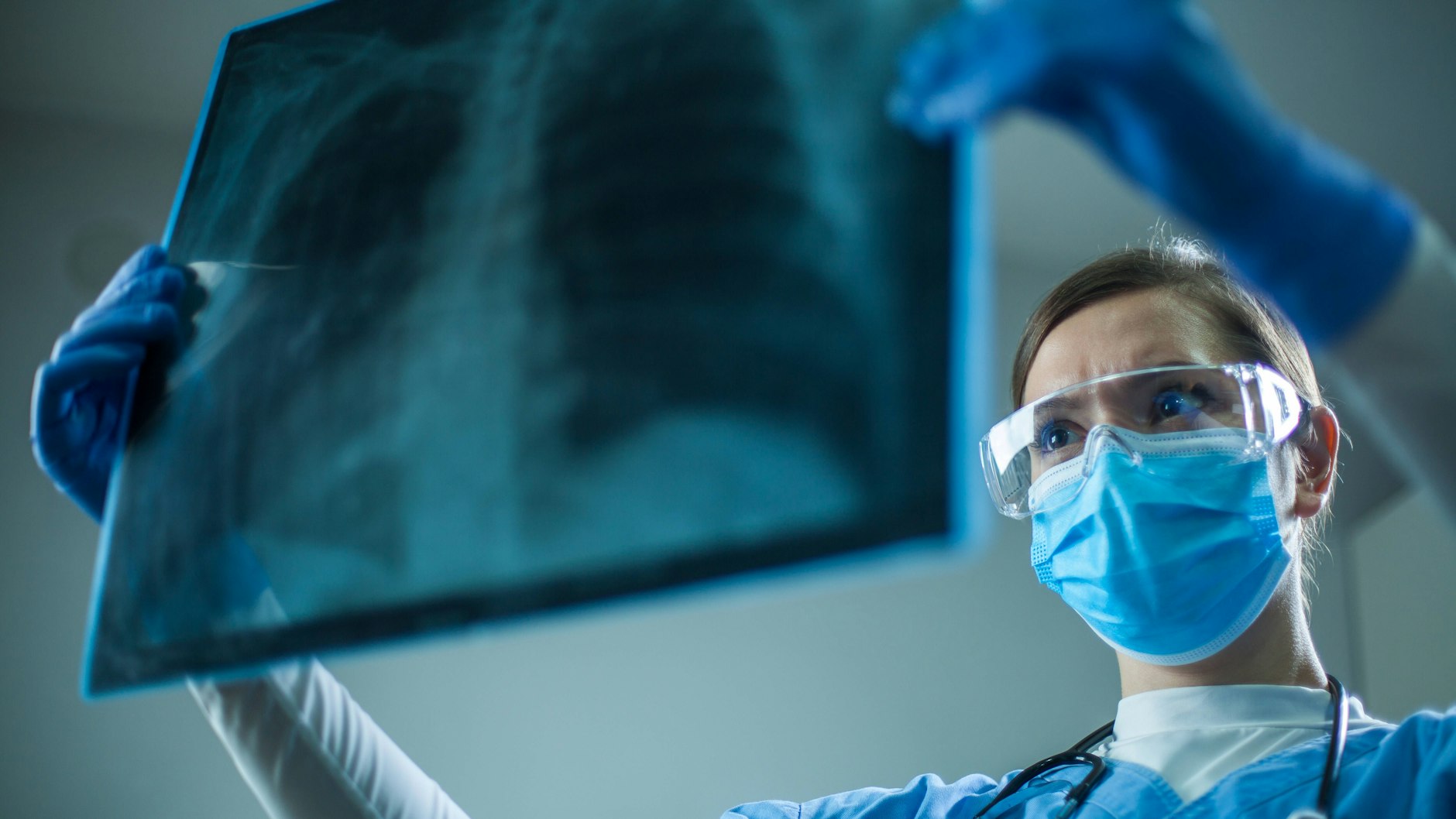 Eine Ärztin betrachtet das Röntgenbild einer Lunge (Symbolbild).