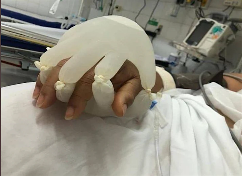Eine schwer an Covid-19 erkrankte Patientin hatte der Krankenpflegerin zu verstehen gegeben, dass sie ängstlich sei und sich nach menschlicher Nähe sehne.