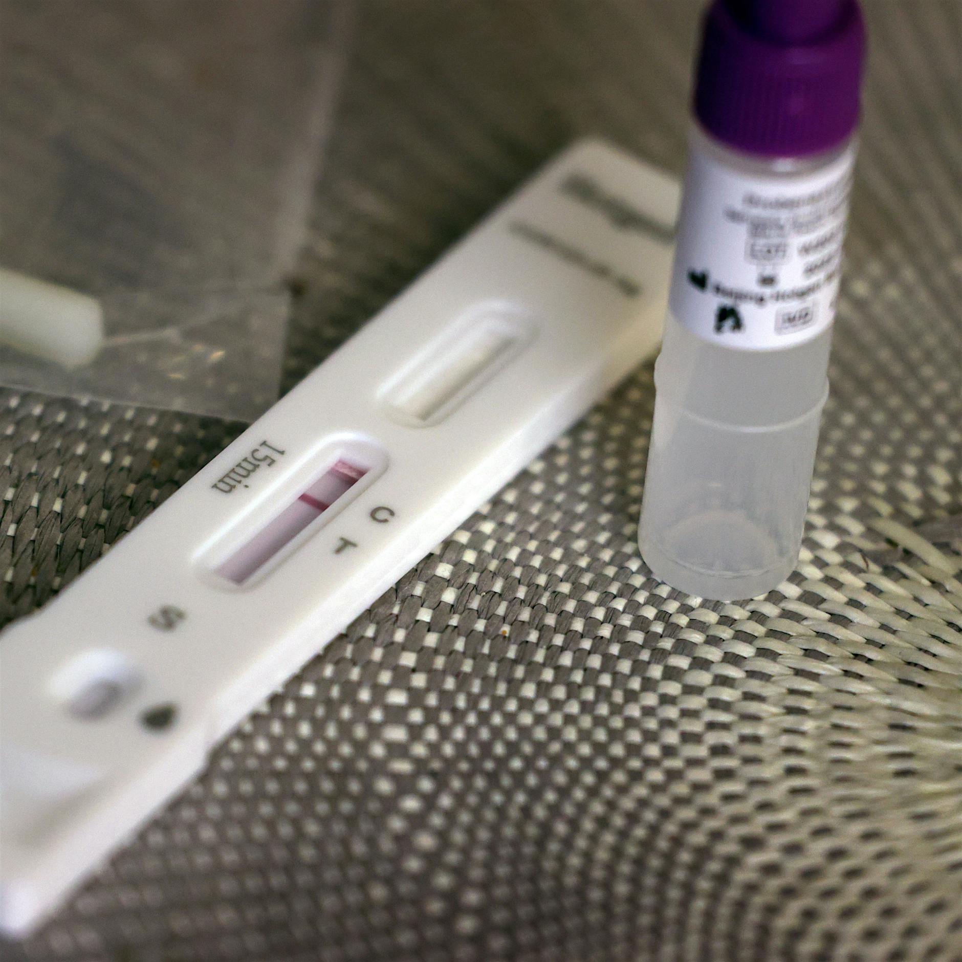 Corona-Tests in Betrieben: Das ist überfällig!