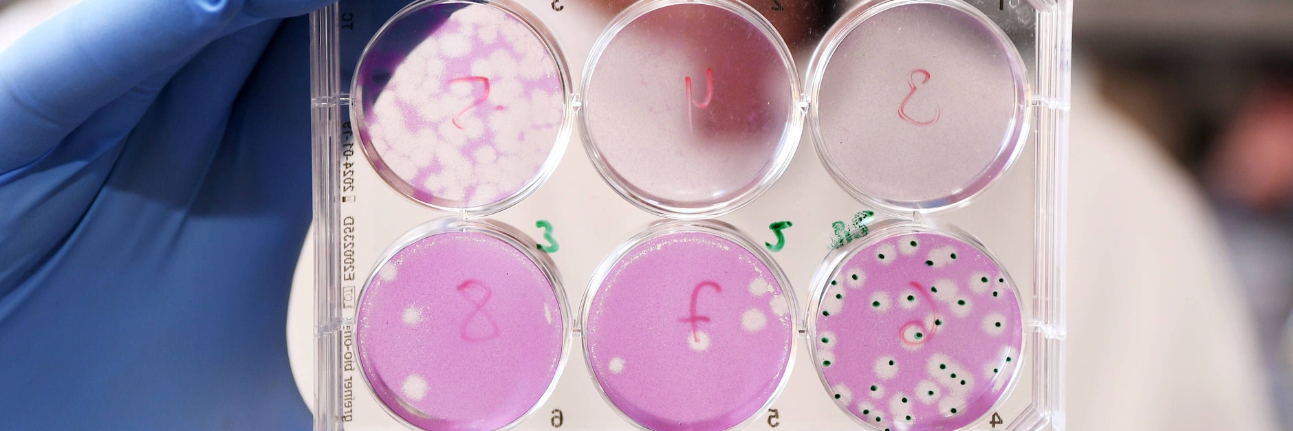 Ein Forscher hält eine Virenkultur in die Kamera (Symbolfoto).