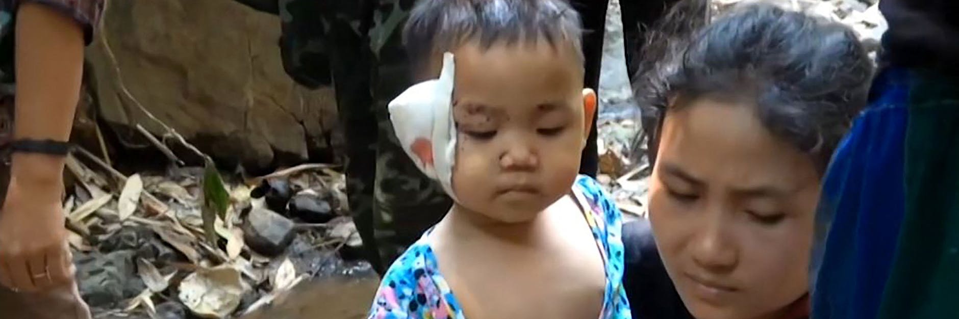 Diese Mutter floh mit ihrem verletzten Kind vor den Luftangriffen des Militärs in Myanmar.