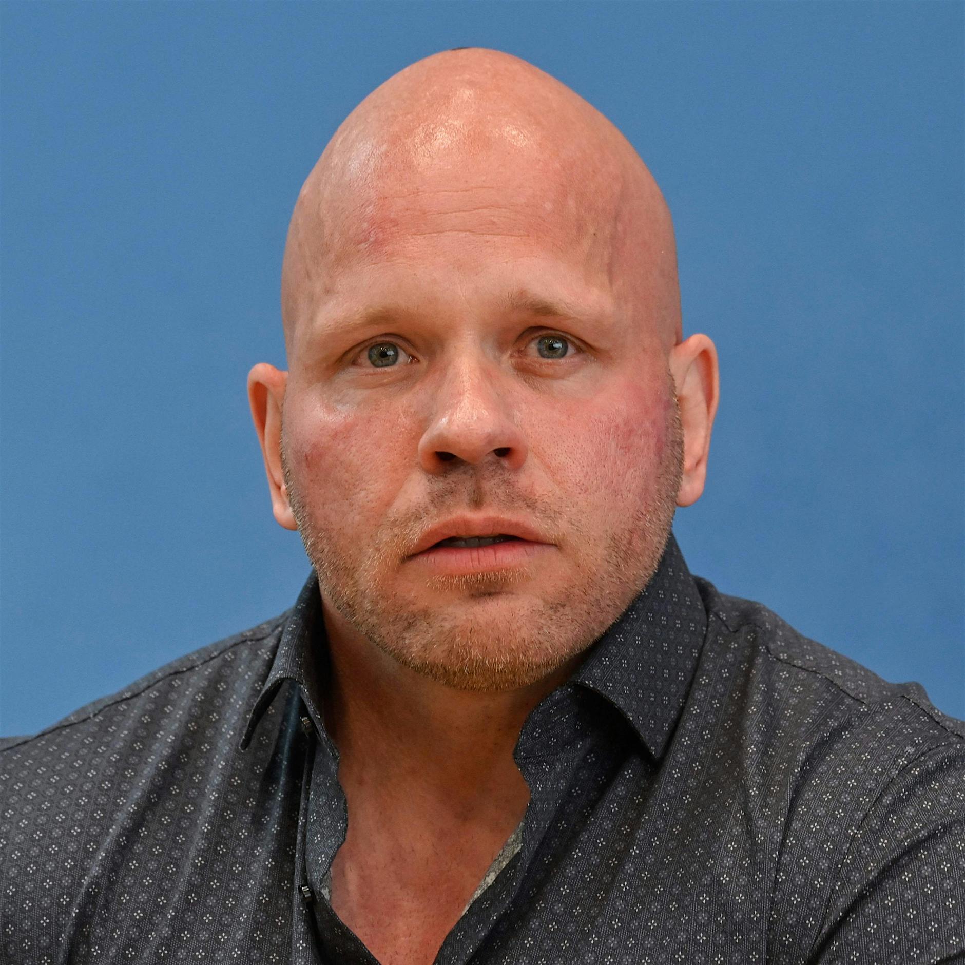 Intensivpfleger aus Berlin: In normalen Zeiten sterben Patienten anders