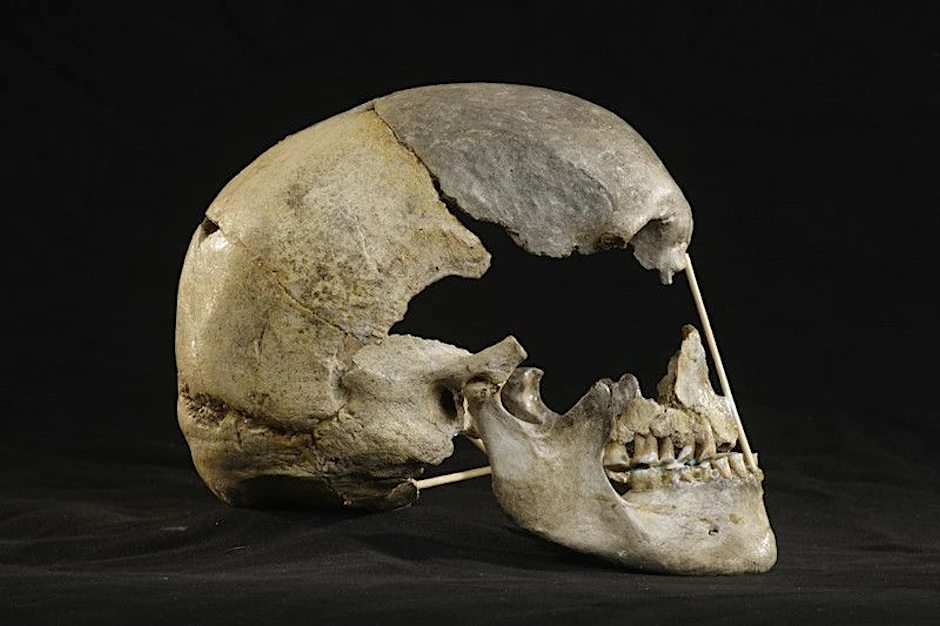 Aus diesem in Tschechien entdeckten Frauenschädel – Schädel von Zlatý kůň genannt – rekonstruierten Forscher das älteste Genom eines modernen Menschen. Die Frau lebte vor mindestens 45 000 Jahren.&nbsp;