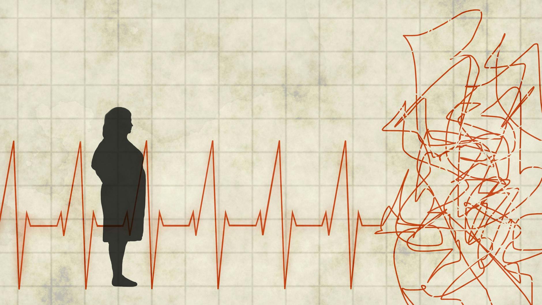 Der Herzinfarkt gilt oft als reine Männerkrankheit. Ein Trugschluss. Ein Herzinfarkt wird bei Frauen häufig zu spät erkannt, weil die Symptome untypisch sind.