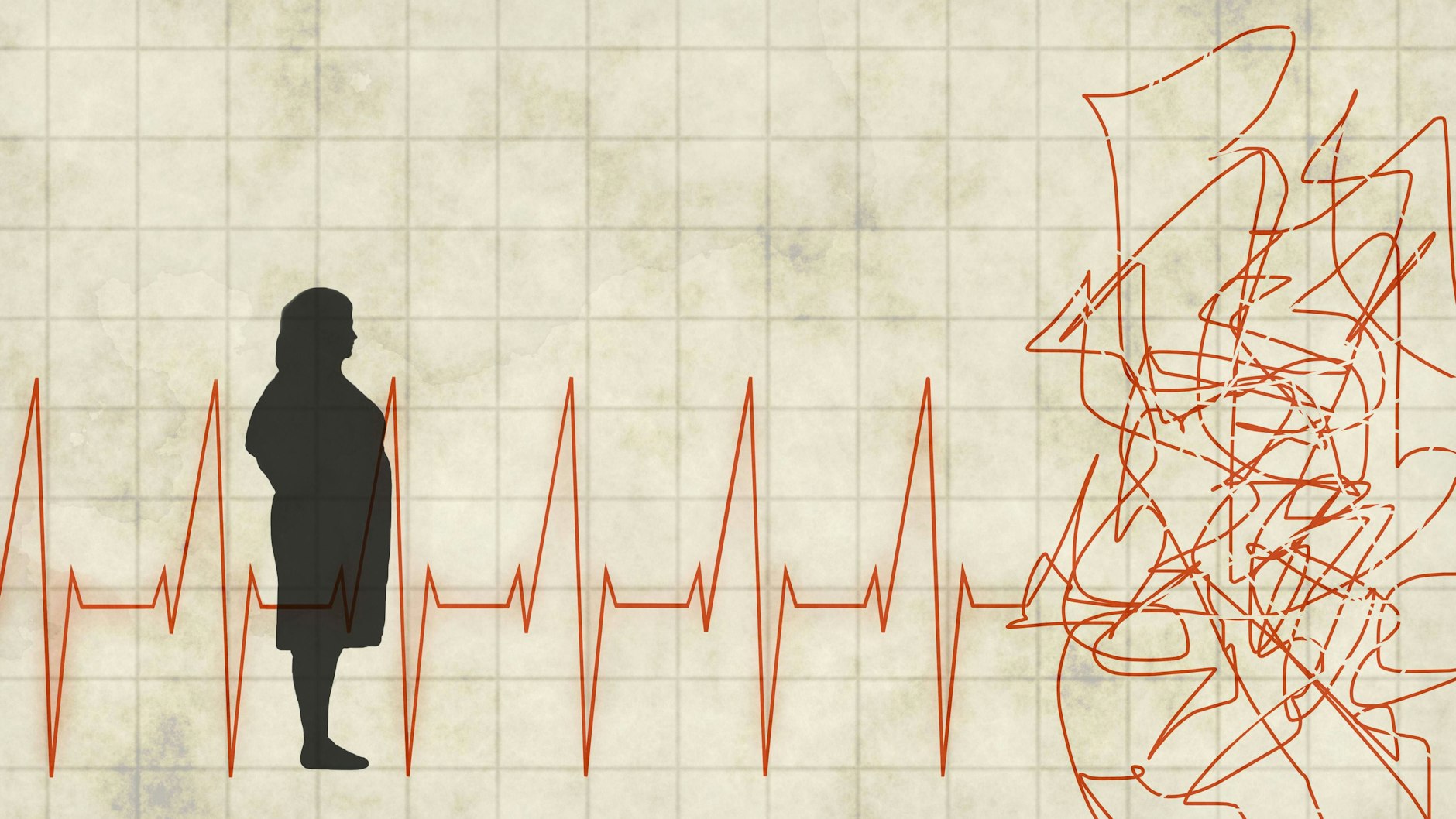 Der Herzinfarkt gilt oft als reine Männerkrankheit. Ein Trugschluss. Ein Herzinfarkt wird bei Frauen häufig zu spät erkannt, weil die Symptome untypisch sind.