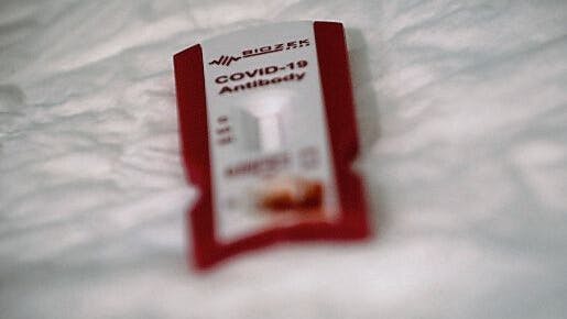 Ob nach der Impfung oder durchgestandener Covid-19-Erkrankung: Viele Menschen wollen wissen, ob sie danach gegen das Virus geschützt sind. Liefern Tests die erwünschte Antwort?