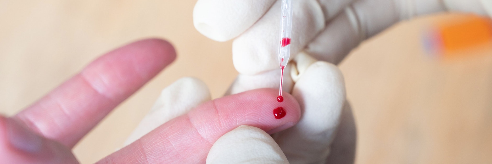 Für einen Corona-Antikörpertest muss Blut abgenommen werden.&nbsp;