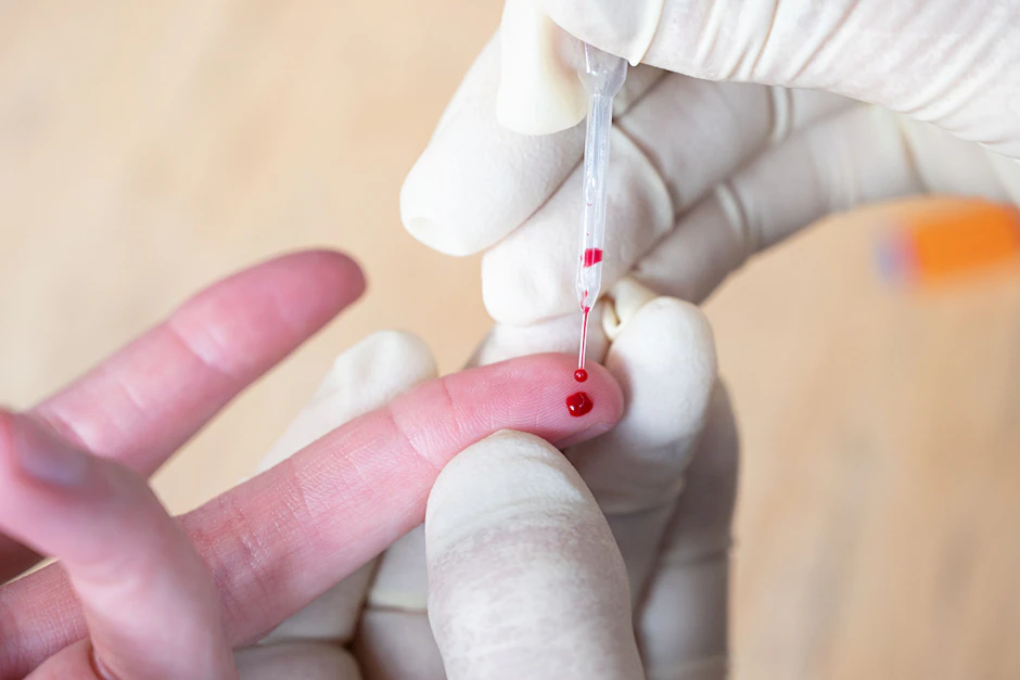 Für einen Corona-Antikörpertest muss Blut abgenommen werden.&nbsp;