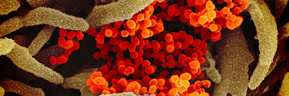 Das Coronavirus unter einem speziellen Mikroskop.