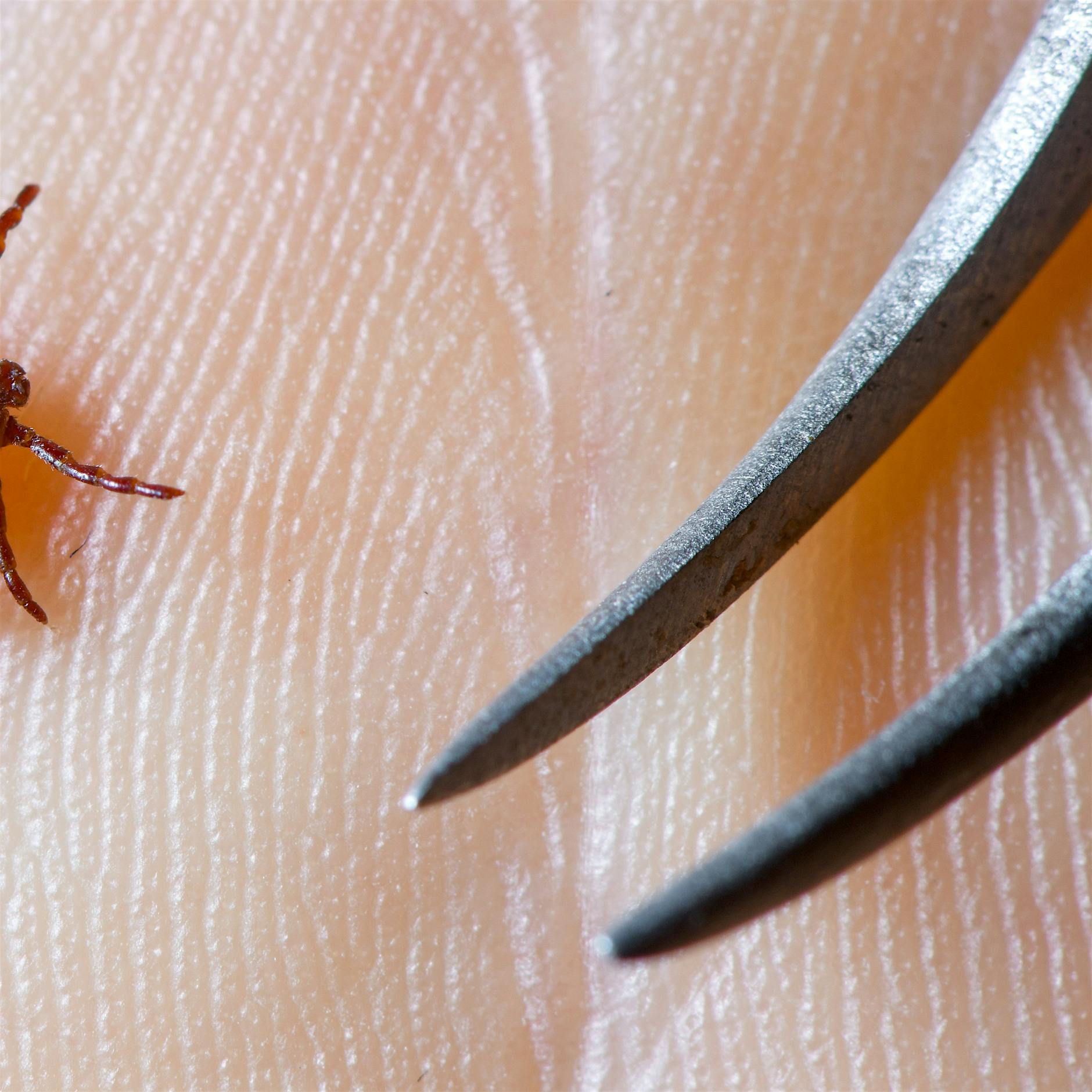 Zeckengefahr: Wann sich eine Impfung gegen FSME lohnt