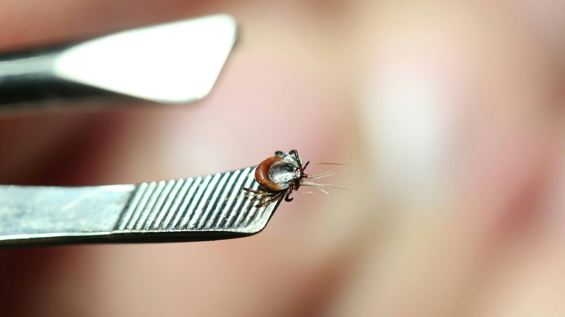 Wer auf der Haut eine Zecke entdeckt, sollte sie möglichst rasch entfernen.