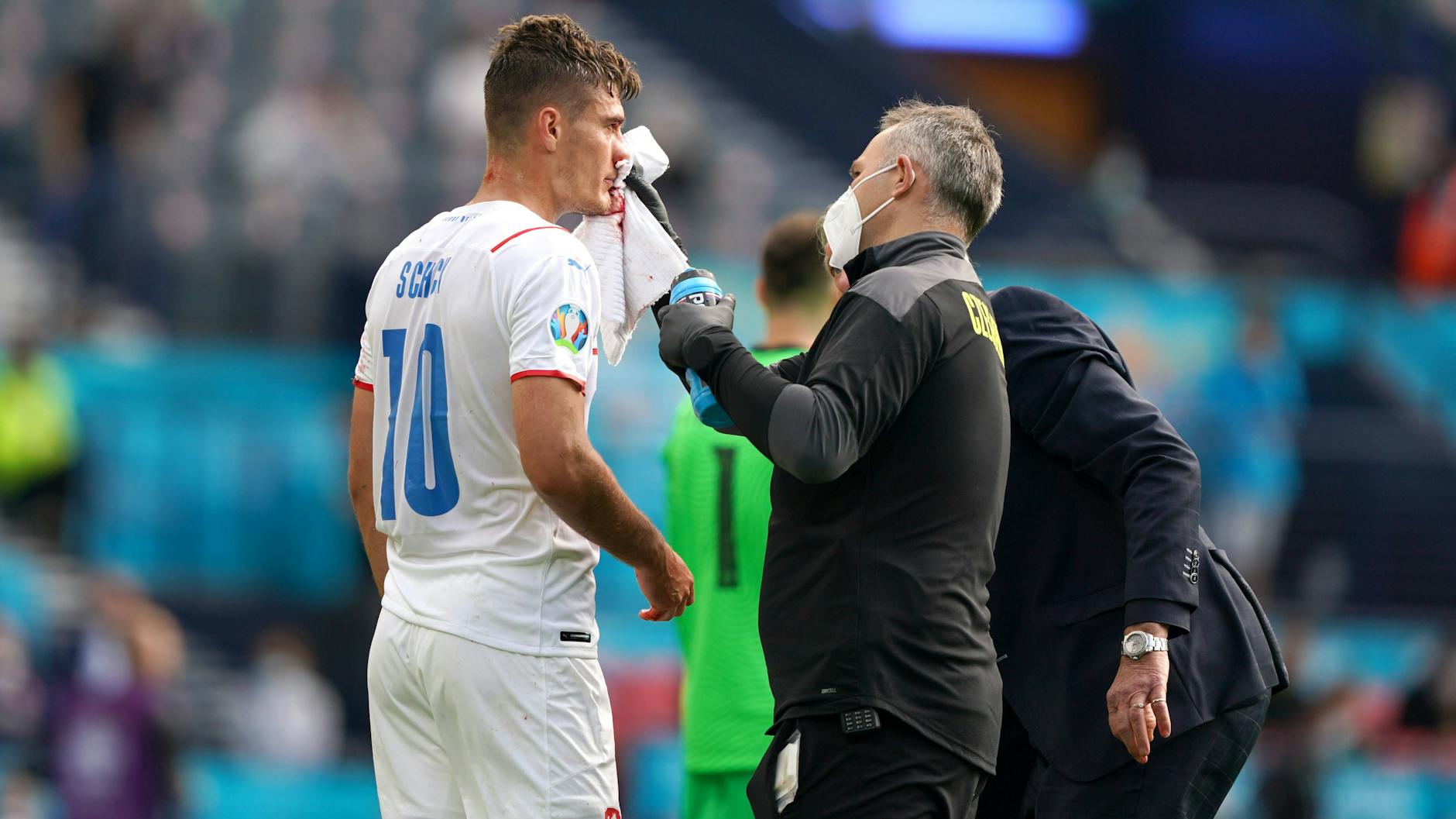 Hat seinen Torriecher trotz blutiger Nase nicht verloren: Tschechiens Patrik Schick traf gegen Kroatien vom Elfmeterpunkt.