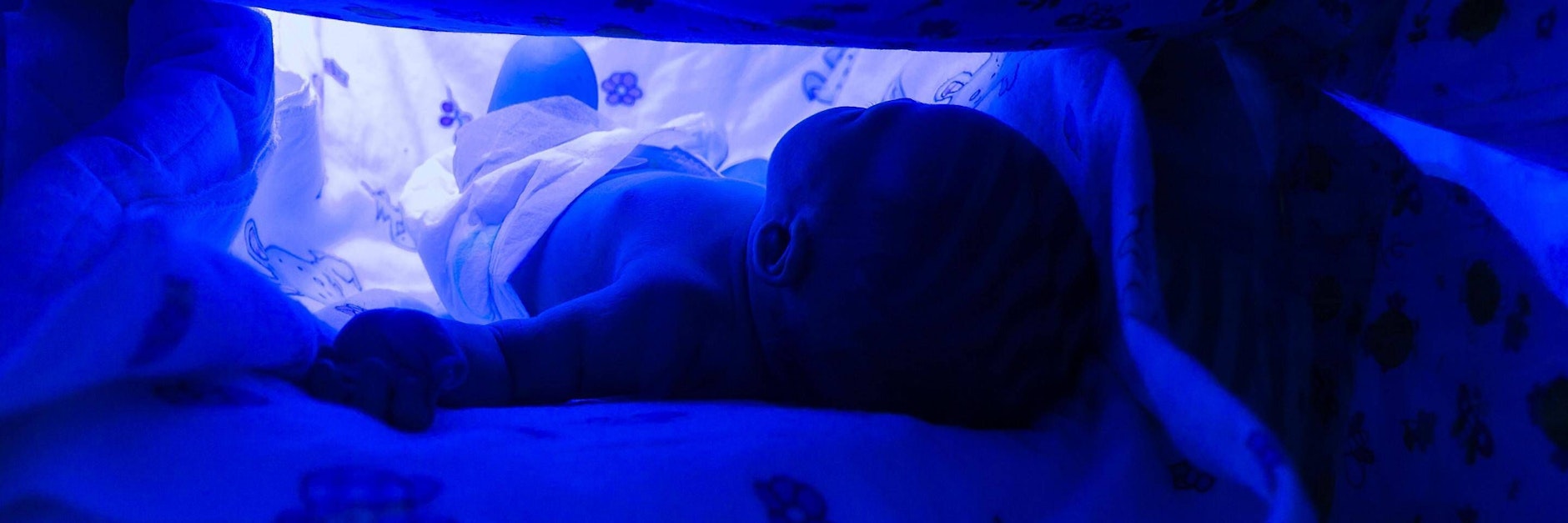 Ein Keim im Krankenhaus hat zum Tod eines Frühchens in Oldenburg geführt. Noch ist unklar, wie der Erreger in die Milchpulvernahrung kam.