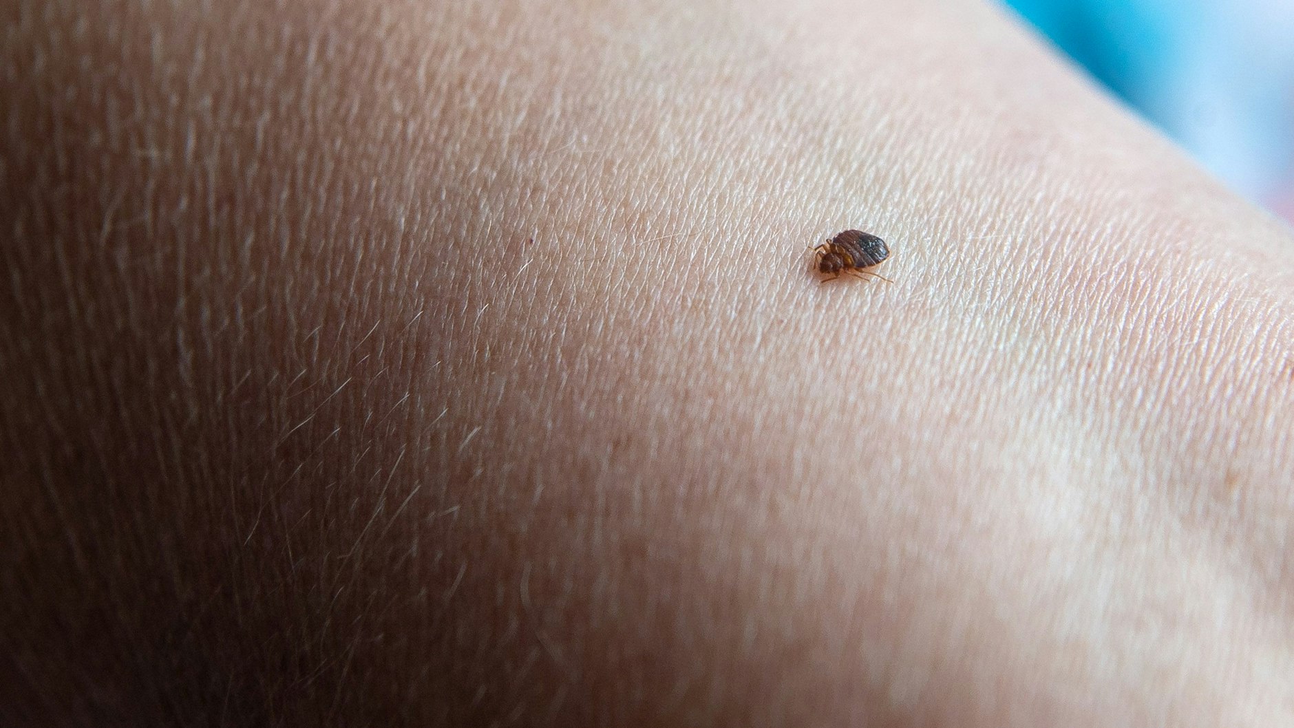 Bestimmt nicht jedermanns Sache: Arm hinhalten zur Wanzen-Fütterung