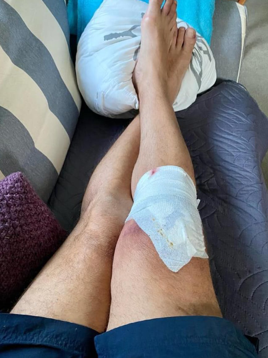 Dieses Foto postete Silly-Gitarrist Uwe Hassbecker nach seinem Dachsturz.