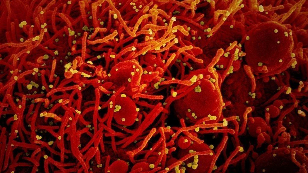 Corona in Berlin: Inzidenz steigt deutlich – auf aktuell 856,4