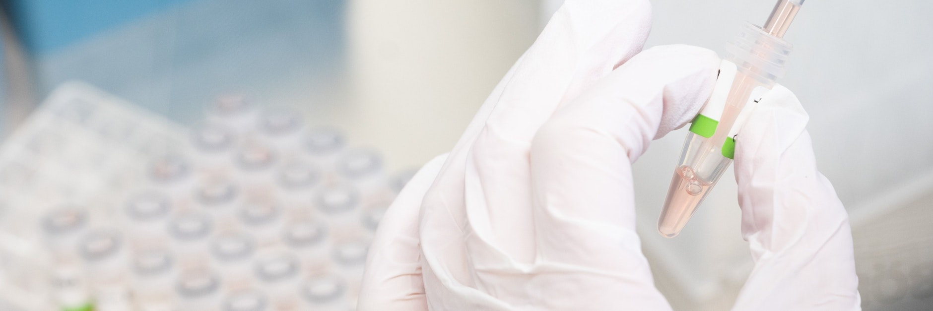 Der Ansturm auf die PCR-Tests übersteigt die Kapazitäten in den Laboren.