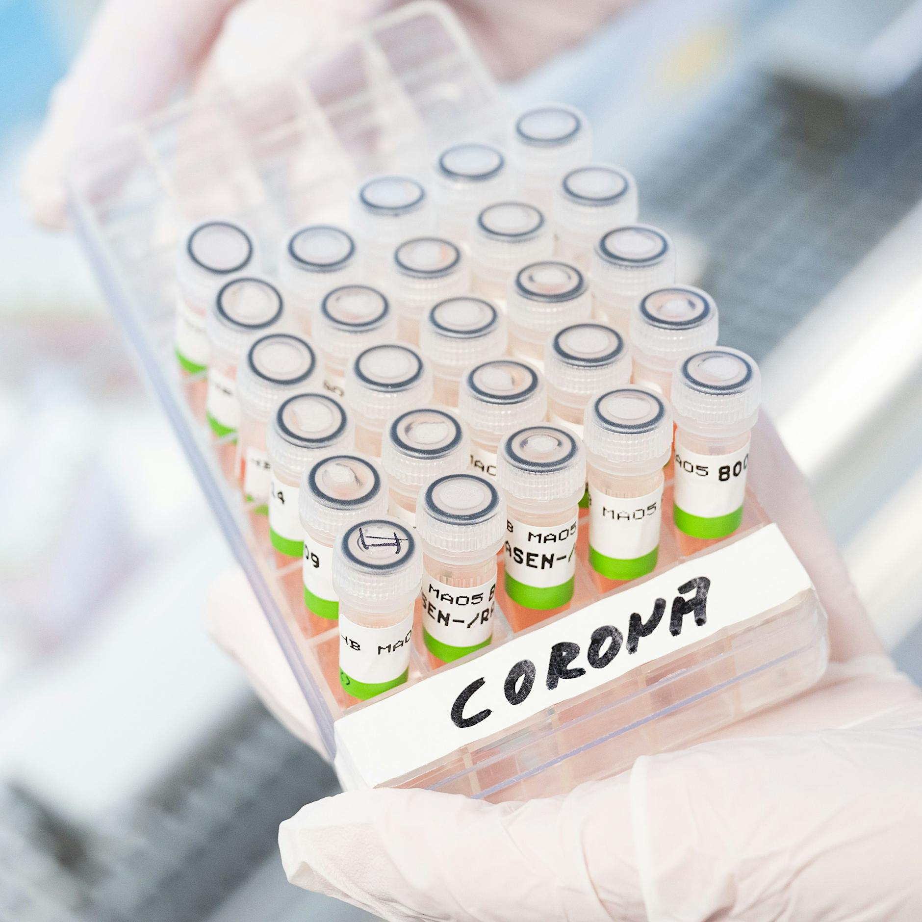 Labore überlastet: Berlin drängt auf Einschränkung von PCR-Tests