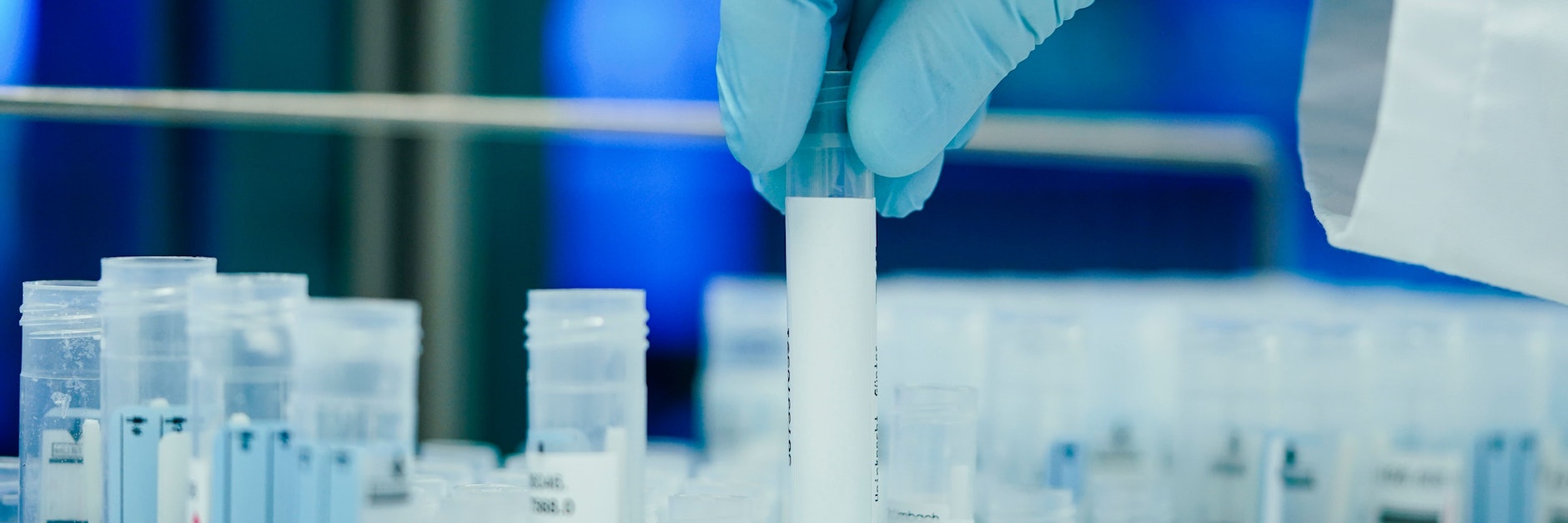 Ein Mitarbeiter hält in einem Corona-Test-Labor PCR-Teströhrchen in den Händen. Angesichts der sich rasant ausbreitenden Omikron-Variante des Coronavirus hat der Laborverband ALM einen Höchstwert an PCR-Testungen pro Woche verzeichnet. 