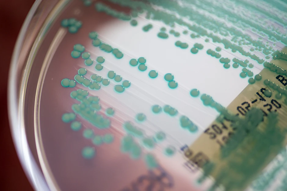 Eine Petrischale mit MRSA-Keimen (Methicillin-resistenten Staphylococcus aureus), die sogenannten Krankenhauskeime.&nbsp;