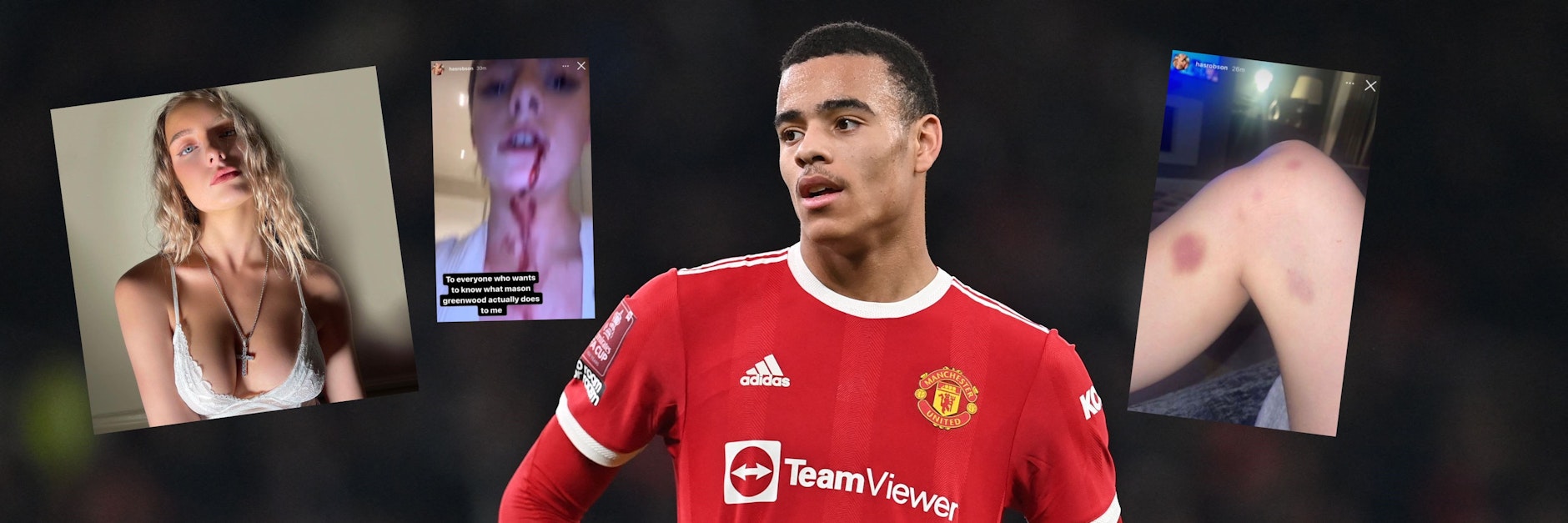 Manchester-Profi Mason Greenwood soll seine Freundin&nbsp;Harriet Robson (l.) brutal verprügelt haben. Fotos und eine Audio-Datei sollen die Misshandlung beweisen.