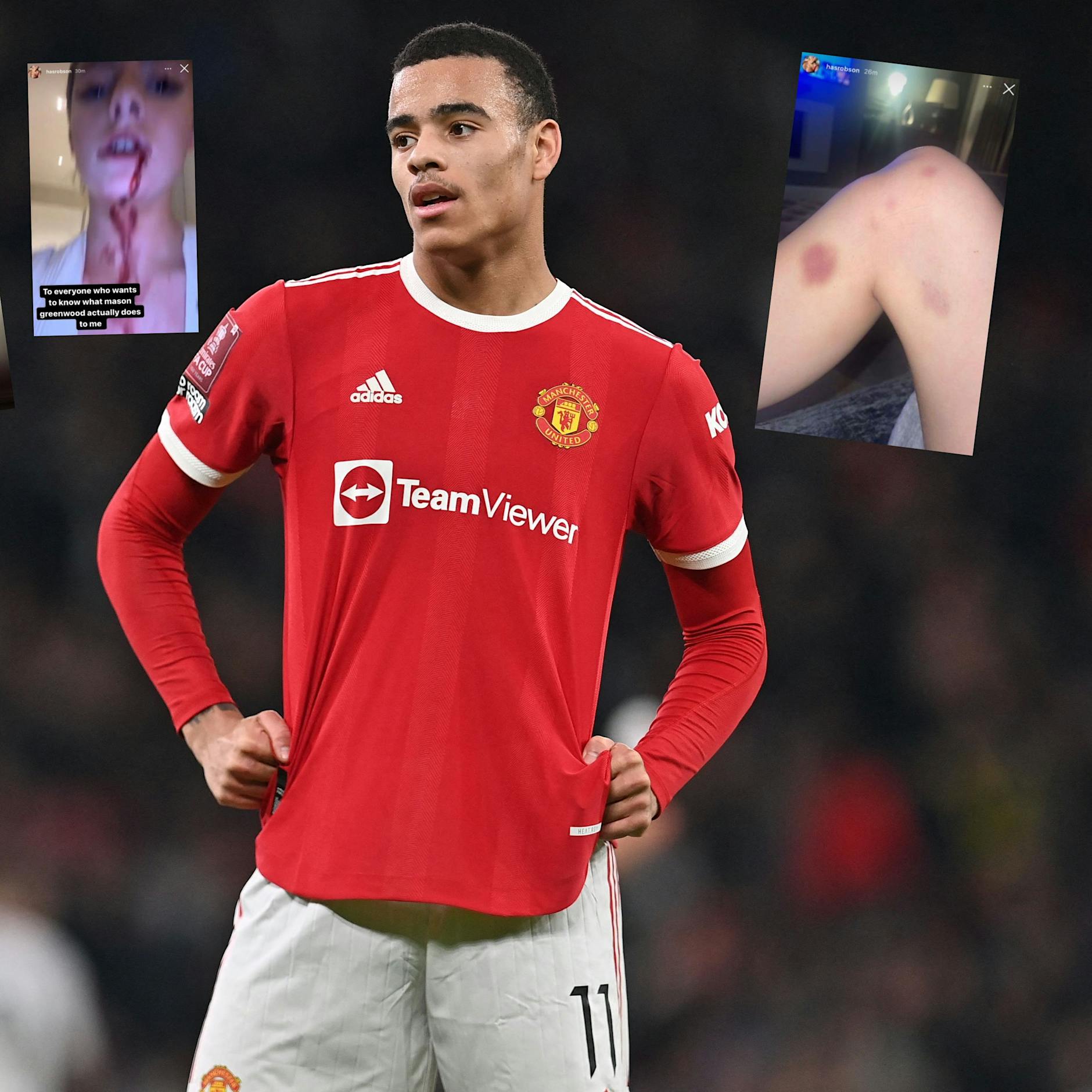 Brutale Bilder und verstörende Audiodatei: Manchester-Profi Greenwood droht Karriere-Ende und Knast