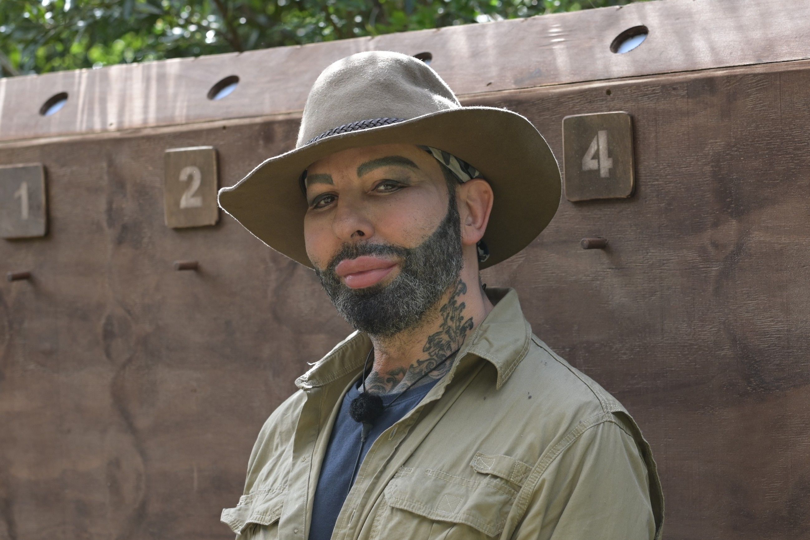 Image - Harald Glööckler packt im Dschungelcamp aus: Das habe ich alles an mir machen lassen!