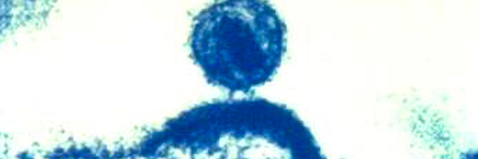 Dieses kolorierte elektronenmikroskopische Bild zeigt ein einzelnes HI-Virus in einer menschlichen Immunzelle.