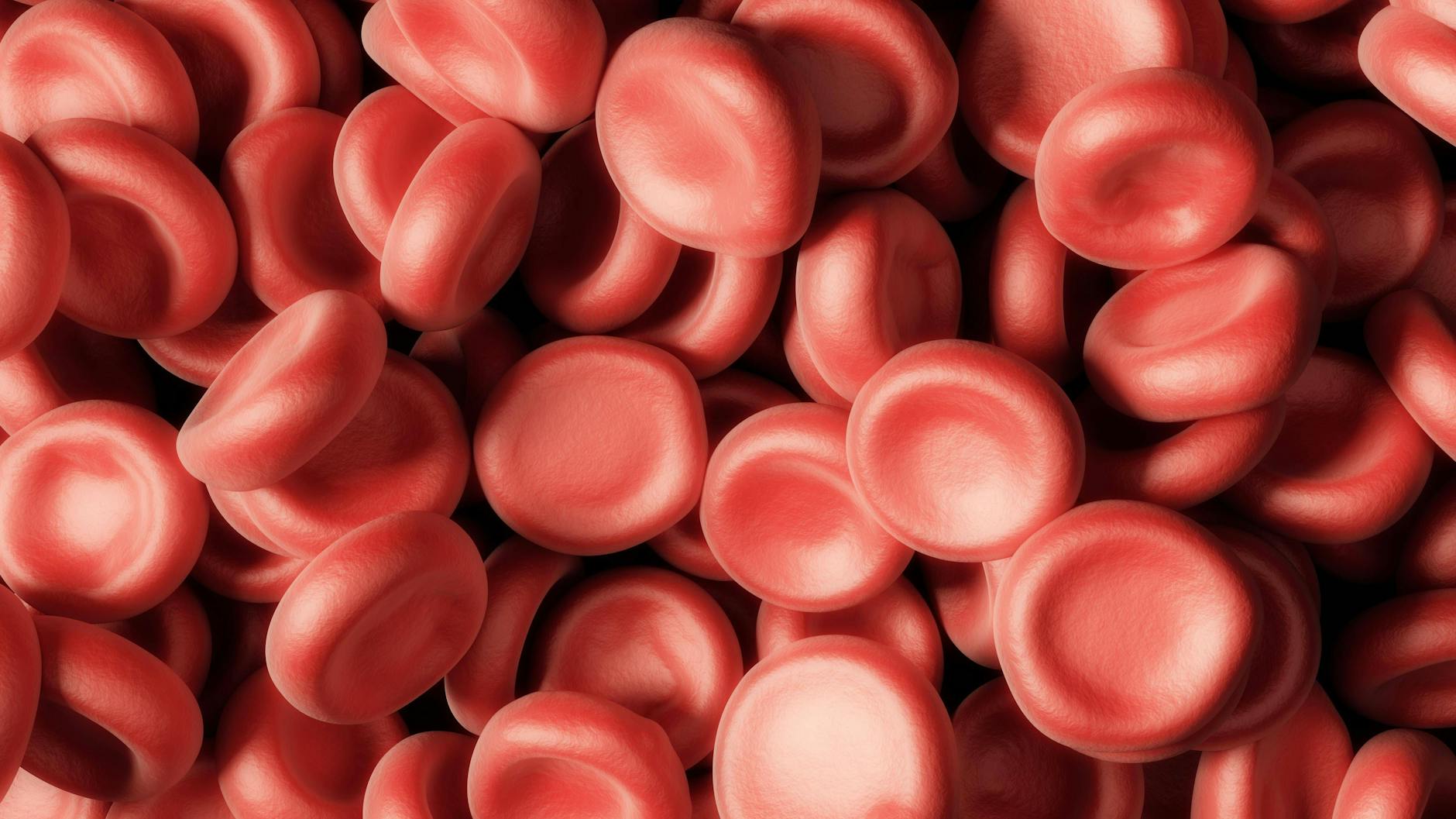 Bei einer akuten Leukämie werden auch die für den Sauerstoff zuständigen roten Blutzellen verdrängt.