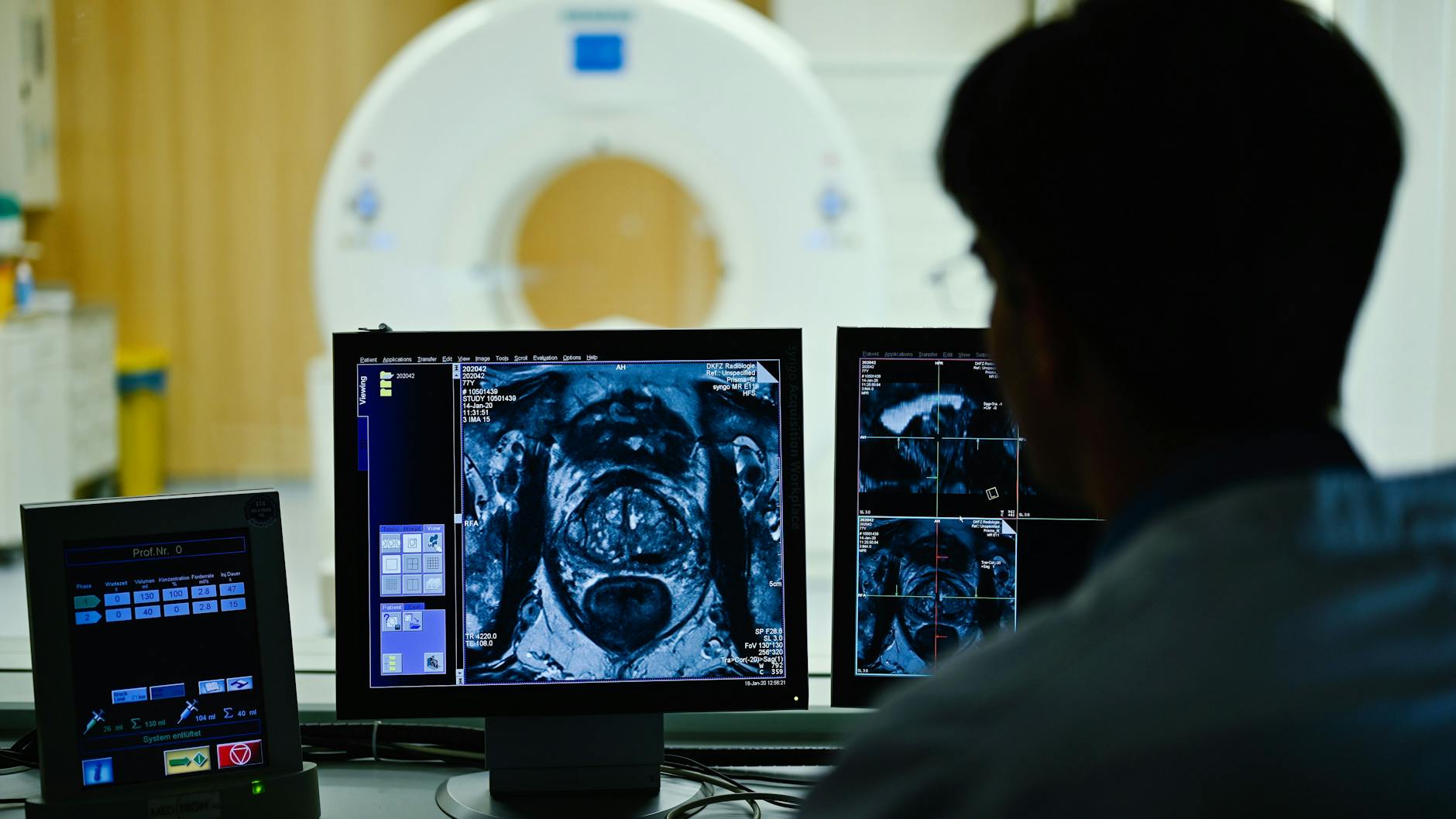 Ein Experte betrachtet eine Querschnittaufnahme der Prostata.