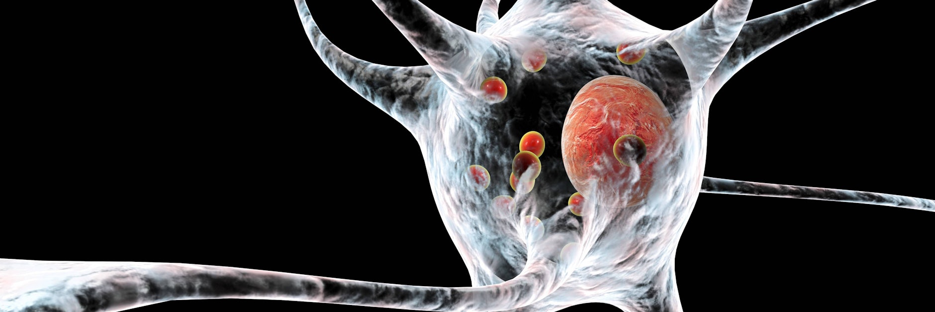 Mit seiner Ernährung kann man dem Gehirn erheblichen Schaden zufügen.