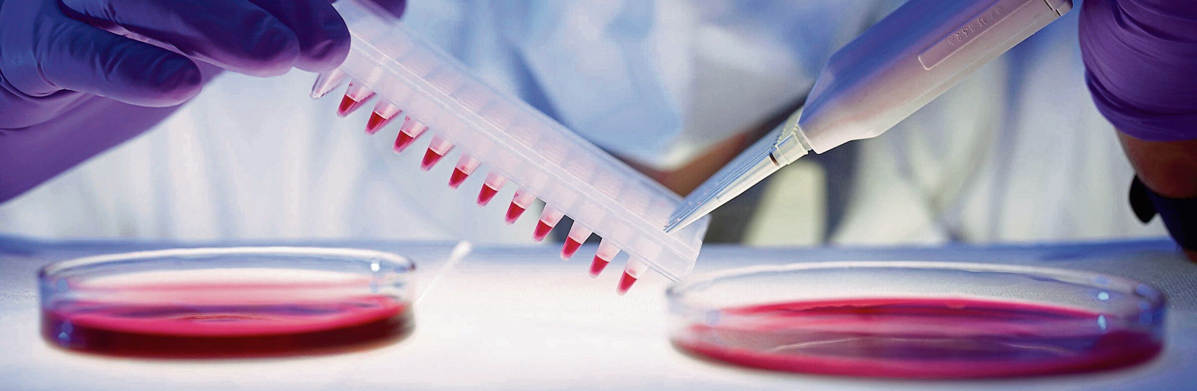 Erste Frau von HIV geheilt – nach Stammzelltransplantation