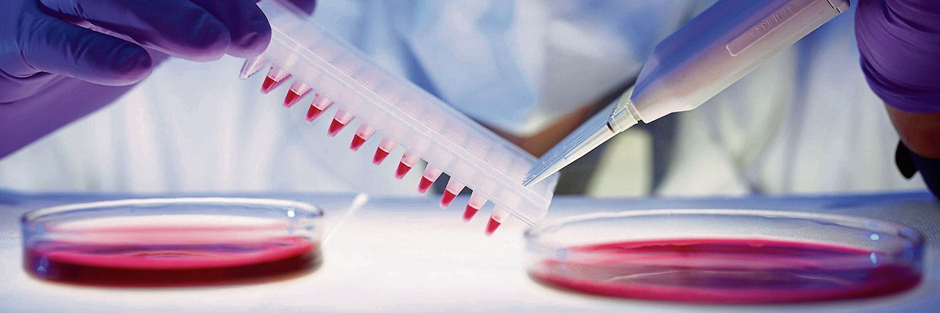 Es ist eine kleine medizinische Sensation: Eine Frau wurde von HIV geheilt.